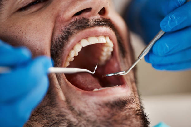 Best Same-Day Emergency Dental Services in Three Oaks, MI
