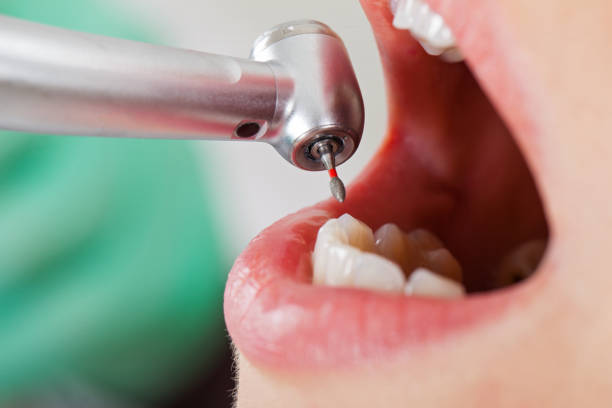 Best Emergency Treatment for Dental Infections or Abscesses in Three Oaks, MI